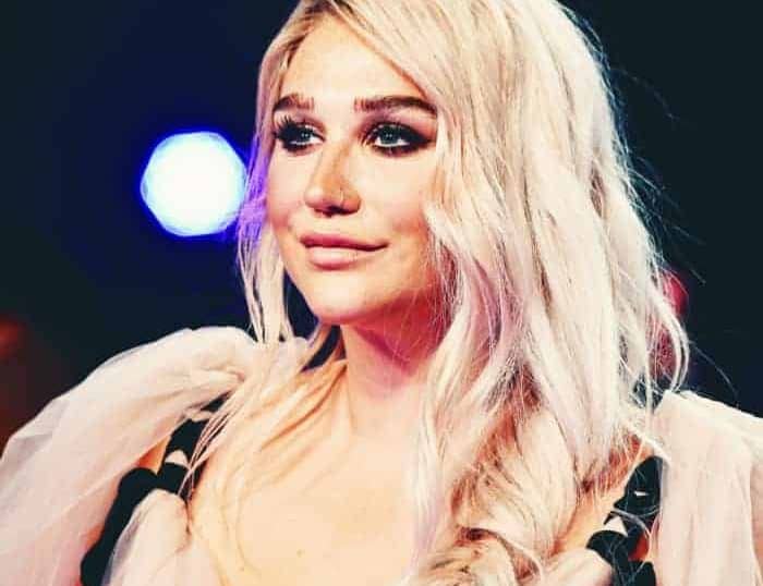 Kesha 