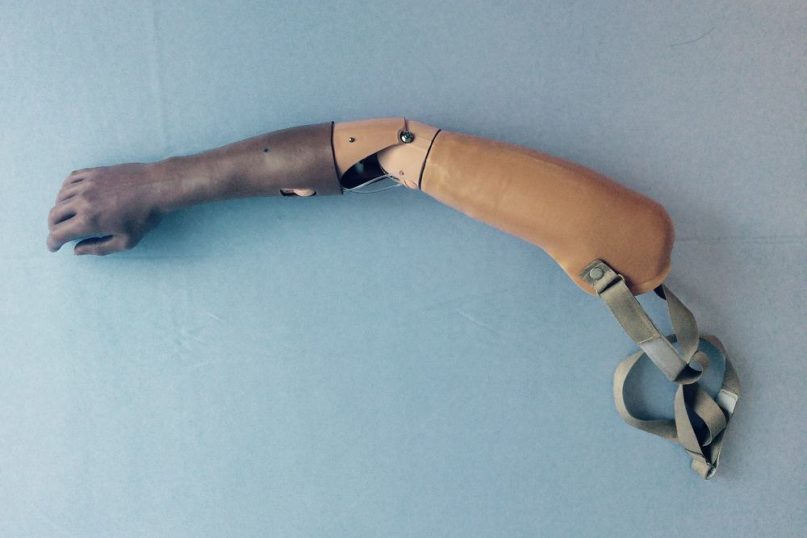 A Prosthetic Limb