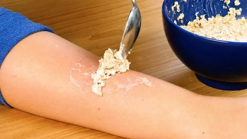 Eczema and oatmeal