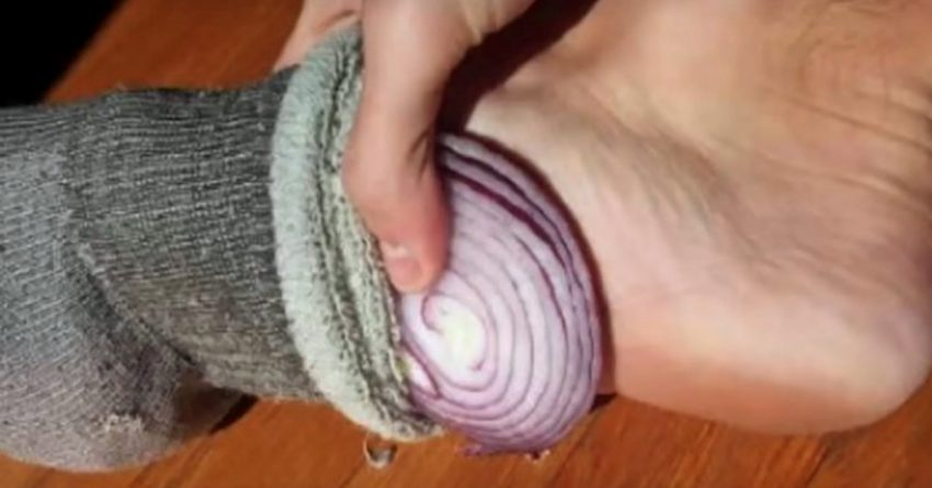 Onion in the sock, party round the clock